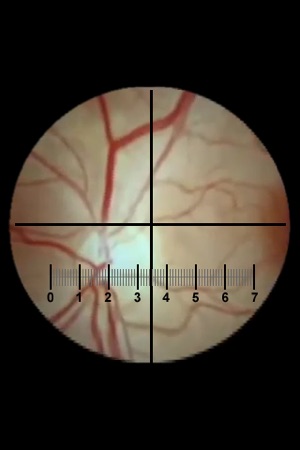 Microscope(圖3)-速報App