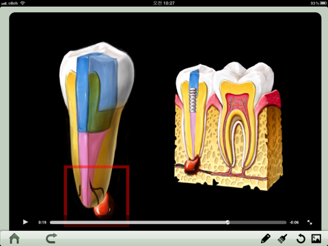 Dental iClinic lite screenshot 3