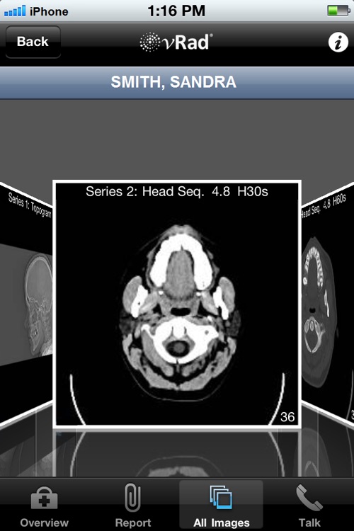 vRad Results