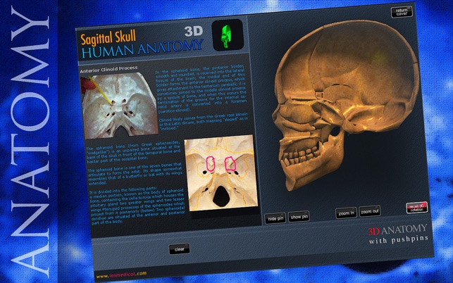 Sagittal Skull 3D