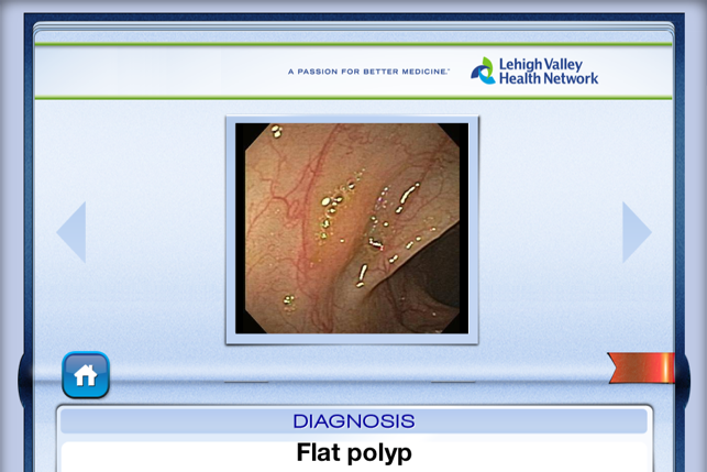 Lower Endoscopy(圖2)-速報App