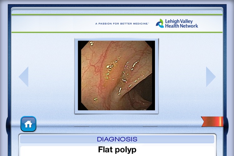 Lower Endoscopy