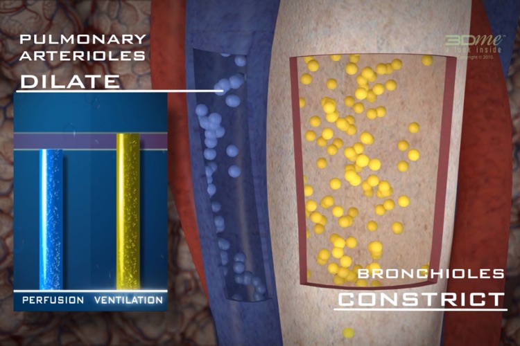 Ventilation Perfusion Matching