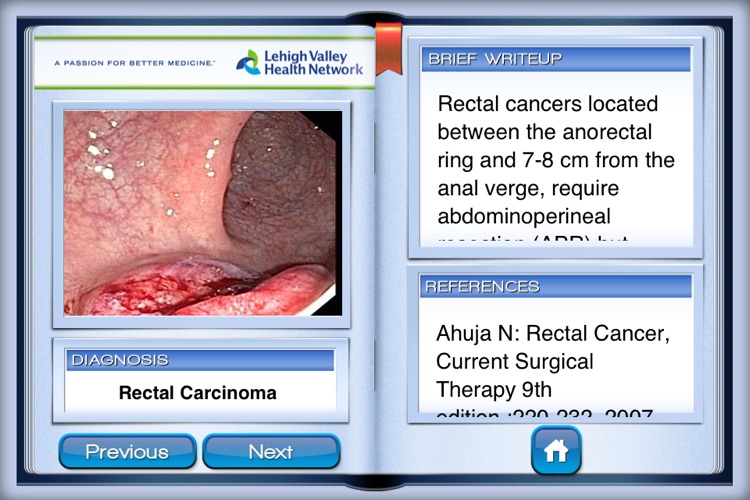 Lower Endoscopy screenshot-4