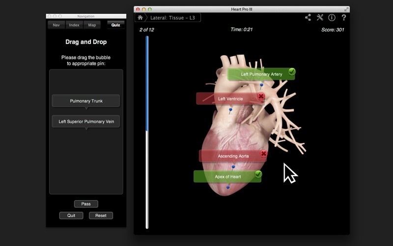 Heart Pro III screenshot1