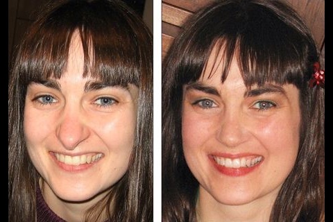 Facial Plastic Surgery: Before and Afters screenshot-3