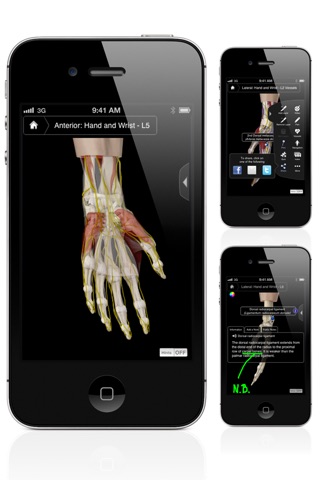 Hand & Wrist Pro III screenshot 3