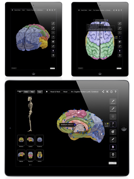 Brain & Nervous System Pro III screenshot-4
