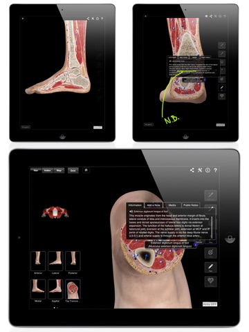 Ankle & Foot Pro III for iPad screenshot 2