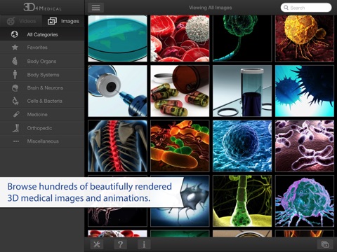 3D4Medical Images & Animationsのおすすめ画像1
