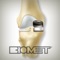 This is an educational tool intended for surgeons to demonstrate to patients the basics of anatomy, the affects of arthritis and how implants can be used as a possible treatment option