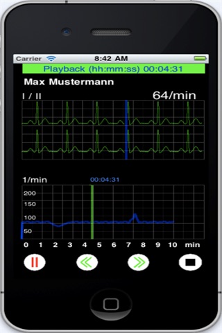 ECG_Recorder screenshot 3