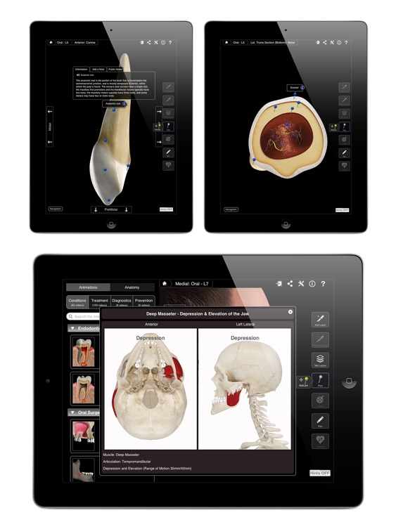 Dental Patient Education screenshot-3
