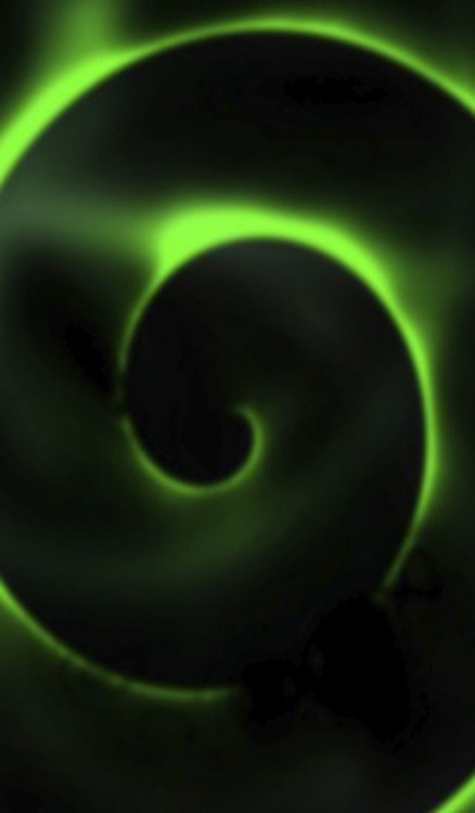 Hypnosis