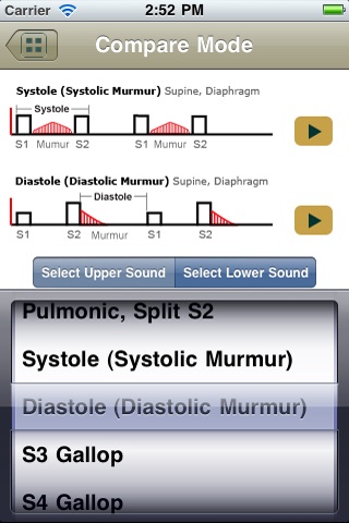 Heart Sound Challenge