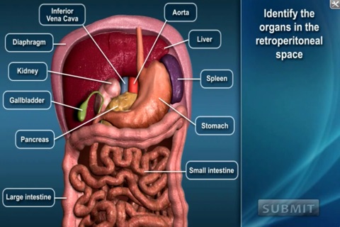 Medrills: Abdominal Emergencies screenshot 4