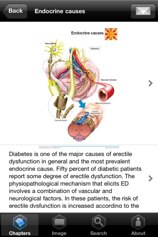 Miniatlas Erectile Dysfunction screenshot 4