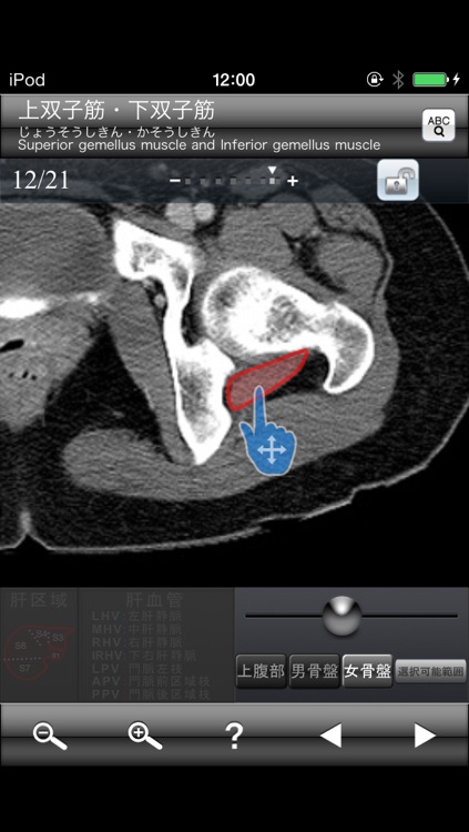 断面図ウォーカー女性骨盤CT無料版