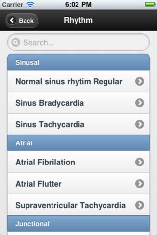 ECG screenshot 2