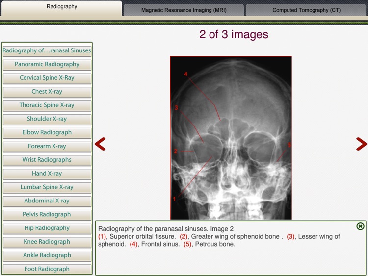 MRI-Xray Human Body