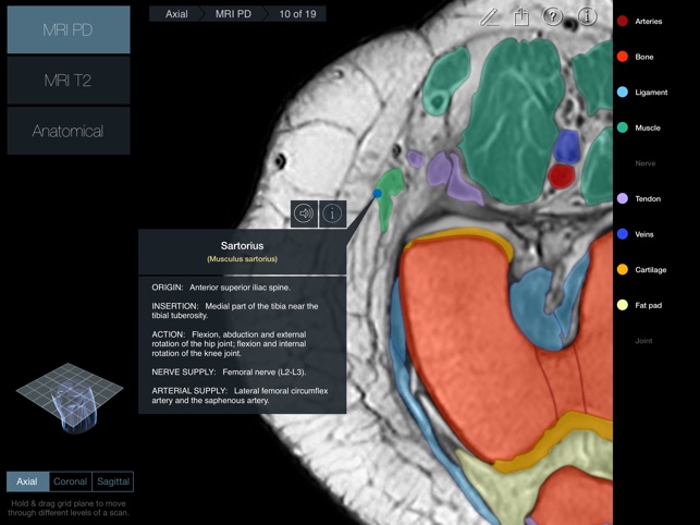 Radiology - Knee(圖3)-速報App