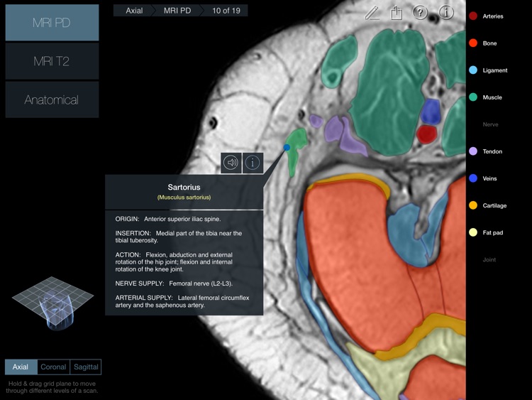 Radiology - Knee