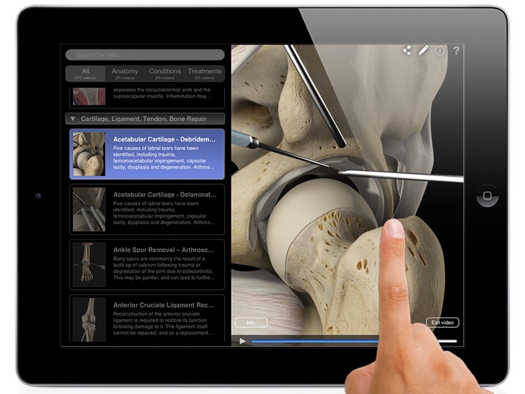 Orthopedic Patient Education