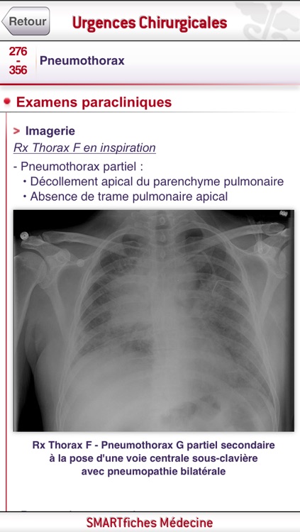 SMARTfiches Urgences Chirurgicales