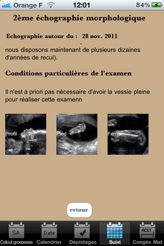 Calcul de terme screenshot 4