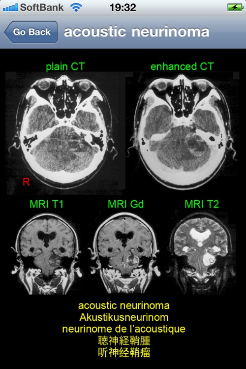neuroradiology multilingual