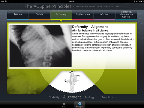 The AOSpine Principles screenshot 4