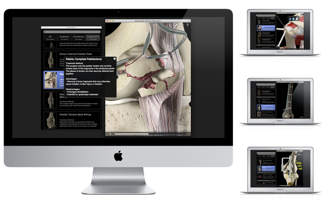 Orthopedic Patient Education(圖3)-速報App