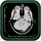 MRI's-Xrays and Cat Scans are all in this App