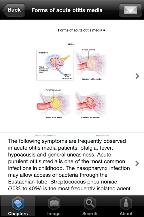 Miniatlas Ear, Nose & Throat screenshot-3