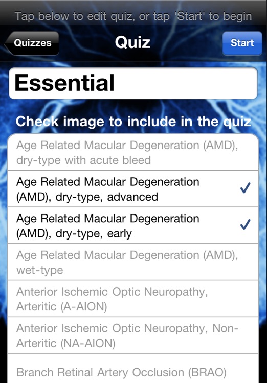 iEye Retina screenshot-3