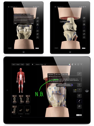 Knee Pro III for iPad screenshot 4