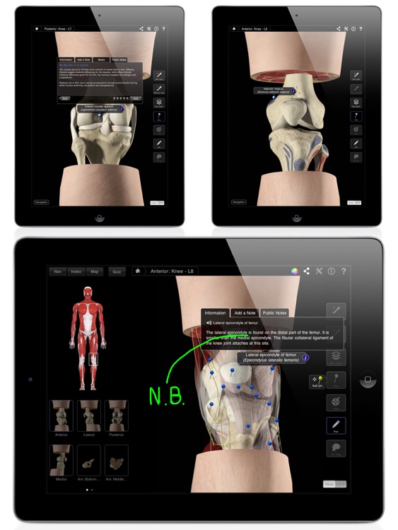 Knee Pro III for iPad screenshot-3