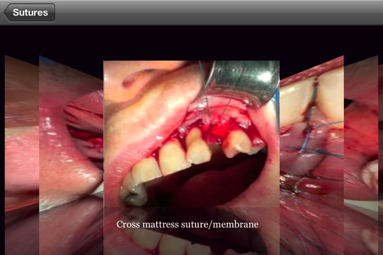 Suturing techniques Videos screenshot-4