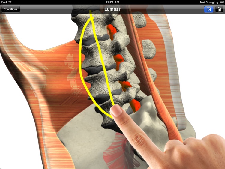 3D Consultation