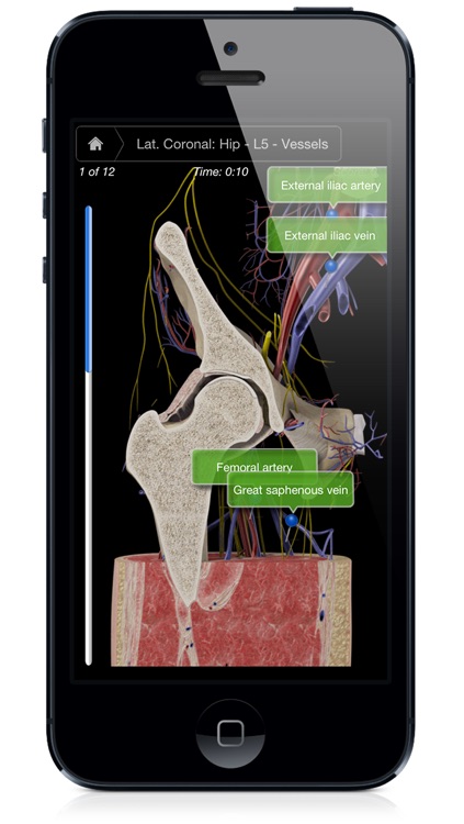 Hip Pro III with Animations - iPhone Edition screenshot-3