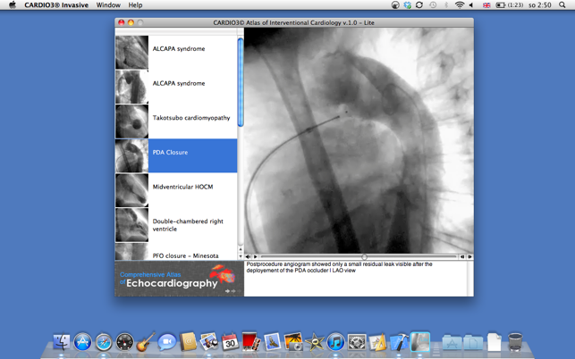 CARDIO3® Atlas of Interventional Cardiology – Lite(圖3)-速報App