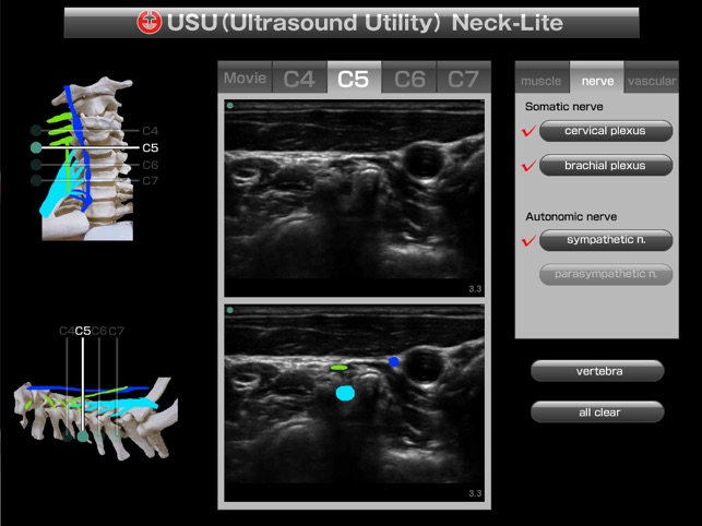 USU neck-lite(圖4)-速報App