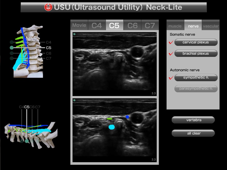 USU neck-lite screenshot-3