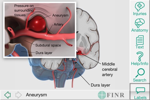 FINR Brain Atlas screenshot 2