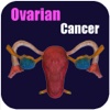 Ovarian Cancer V1