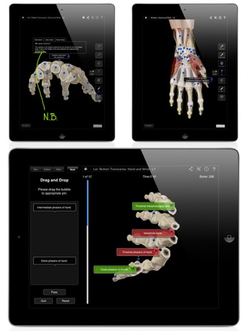 Hand & Wrist Pro III for iPad screenshot 4