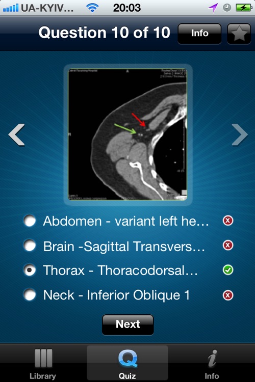 CT Scan screenshot-3