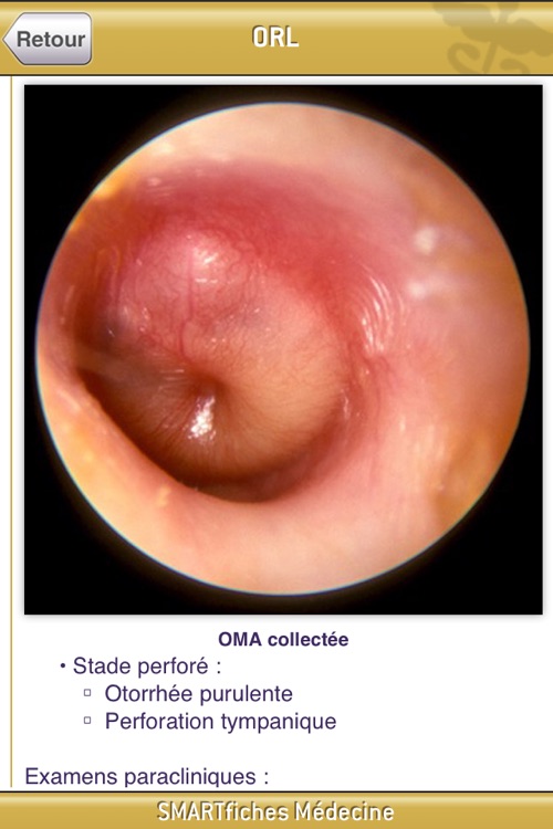 SMARTfiches Oto-Rhino-Laryngologie Free