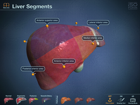 AR Liver Viewer screenshot 3