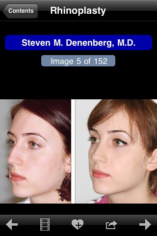 Facial Plastic Surgery: Before and Afters